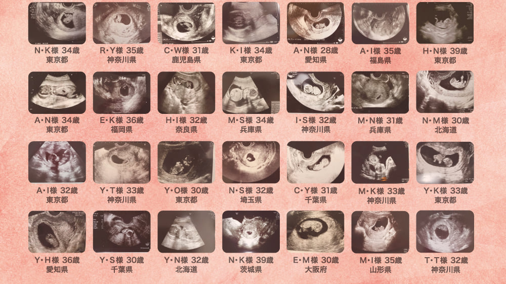 N・K様 34歳 東京都