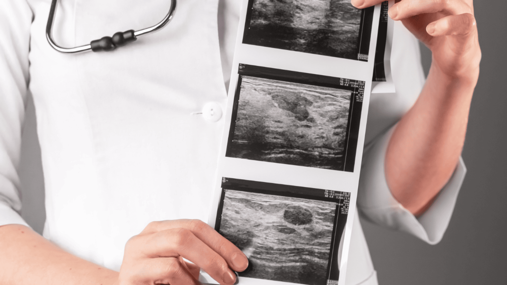 結婚前に把握すべき子宮頸がん検査:ブライダルチェックでのステップと対策