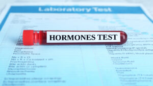 結婚前に把握すべき！ホルモンバランスを知るブライダルチェック